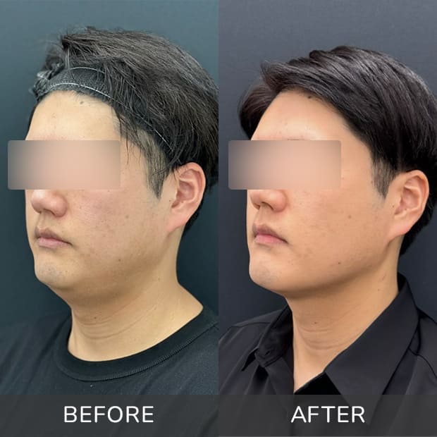 症例写真